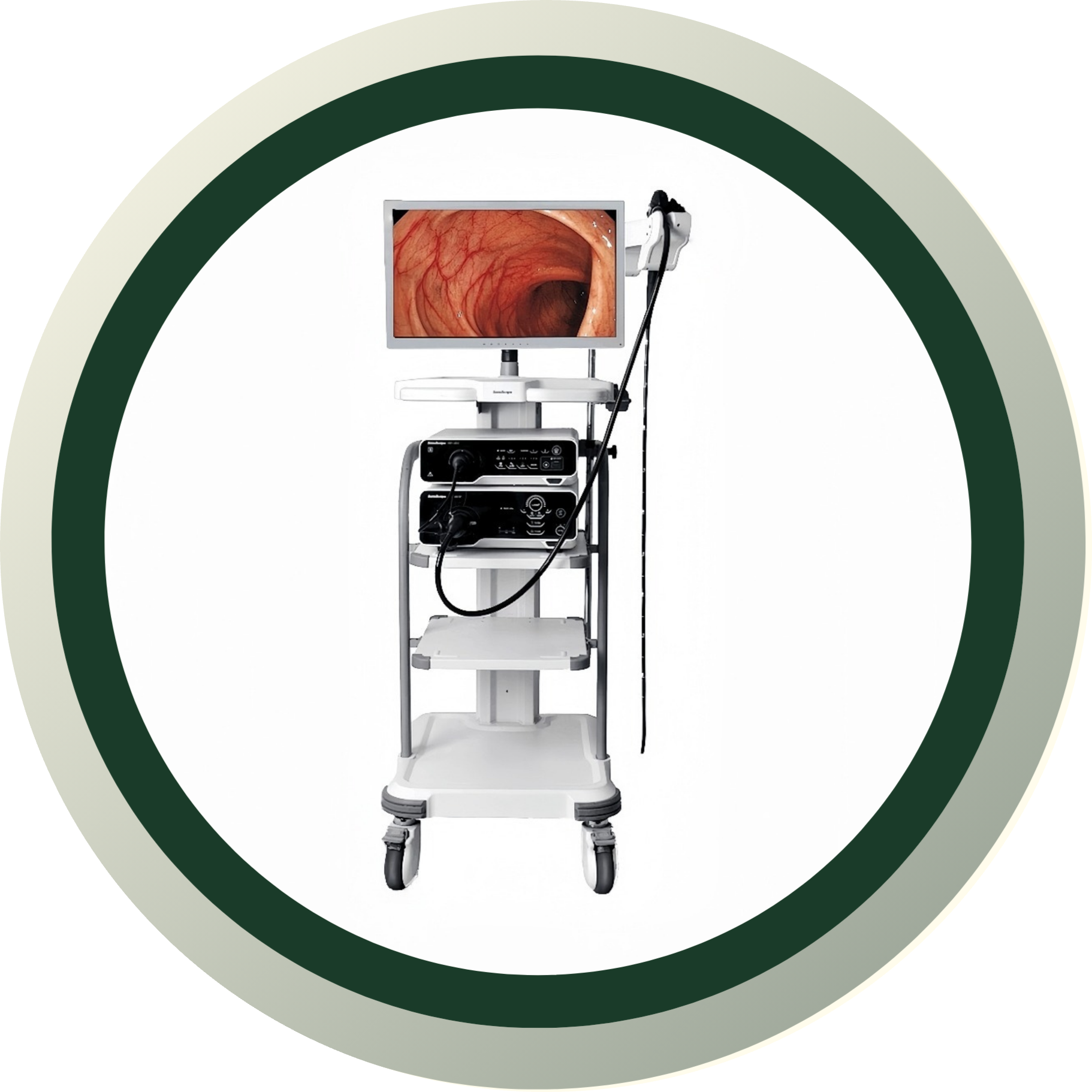 ЭНДОСКОПИЯ