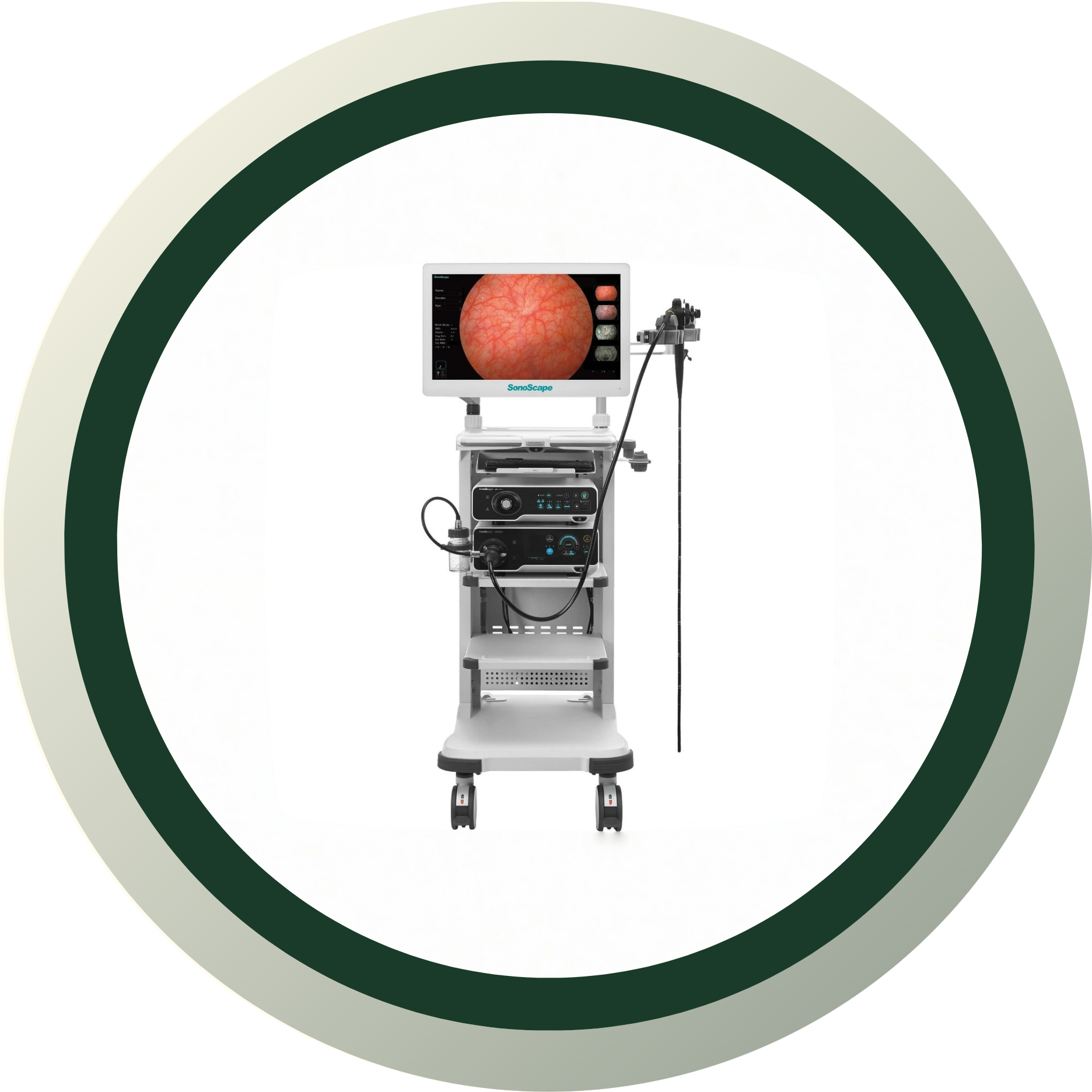 ЭНДОСКОПИЯ